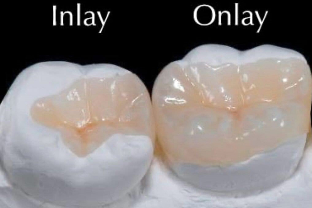 https://vitaldentalclinic.com/wp-content/uploads/2025/10/dew4.jpg